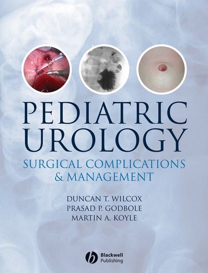 Книга Pediatric Urology - скачать бесплатно в Pdf, Martin A. Koyle