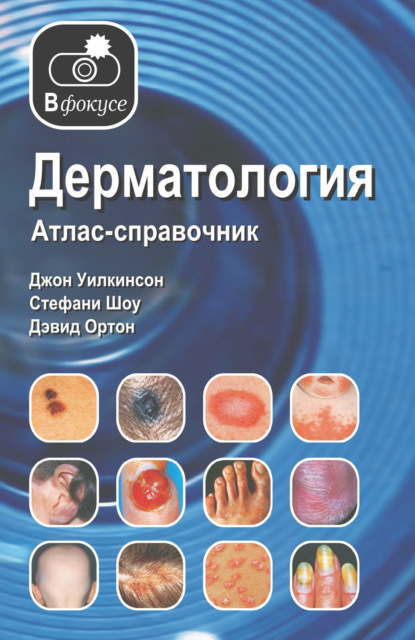 Дерматология. Атлас – справочник