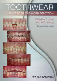Toothwear. The ABC of the Worn Dentition