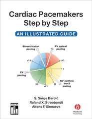 Cardiac Pacemakers Step-by-Step
