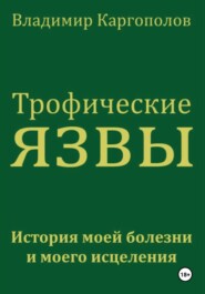 Трофические язвы. История моей болезни и моего исцеления