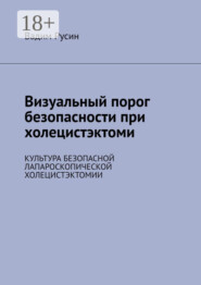 Визуальный порог безопасности при холецистэктоми. Культура безопасной лапароскопической холецистэктомии