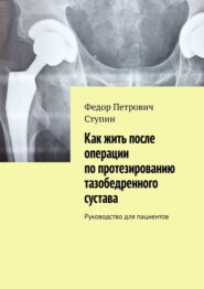 Как жить после операции по протезированию тазобедренного сустава. Руководство для пациентов