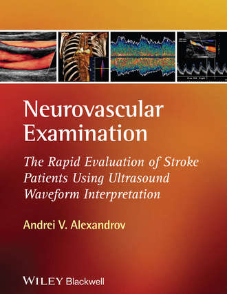 Neurovascular Examination. The Rapid Evaluation of Stroke Patients Using Ultrasound Waveform Interpretation