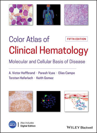 Color Atlas of Clinical Hematology. Molecular and Cellular Basis of Disease