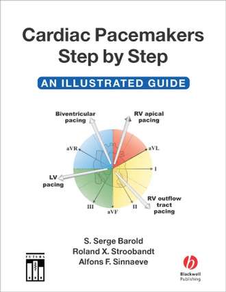 Cardiac Pacemakers Step-by-Step