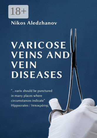 VARICOSE VEINS AND VEIN DISEASES