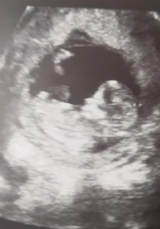 Пепел ангела