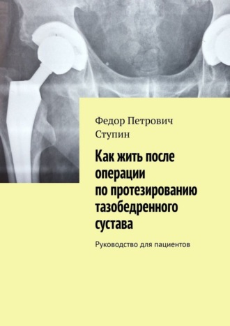 Как жить после операции по протезированию тазобедренного сустава. Руководство для пациентов
