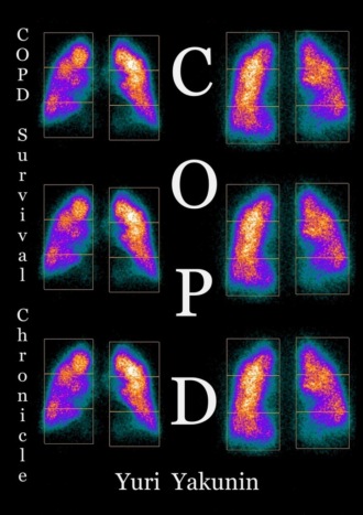 COPD