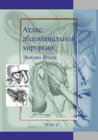 Атлас абдоминальной хирургии. Том 2. Хирургия желудка и двенадцатиперстной кишки