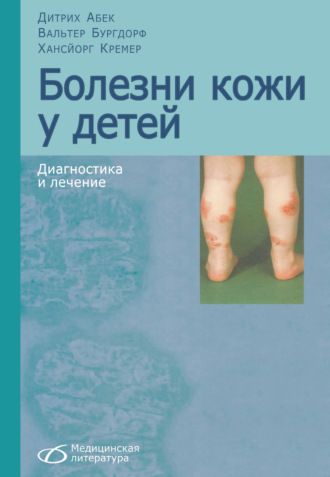 Болезни кожи у детей