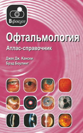 Офтальмология. Атлас – справочник