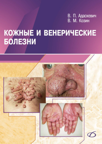 Кожные и венерические болезни