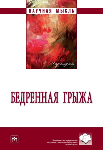 Бедренная грыжа
